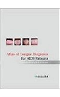 Atlas of Tongue Diagnosis for AIDS Patients (Hardcover, 1st)