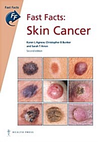 Fast Facts: Skin Cancer (Paperback, 2nd edition (reprinted 2015, with revisions))