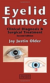 Eyelid Tumors (Hardcover, 2 ed)