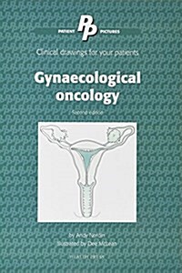 Patient Pictures: Gynaecological oncology : Clinical drawings for your patients Illustrated by Dee McLean. (Spiral Bound, 2nd edition)