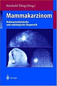 MAMMAKARZINOM (Hardcover)