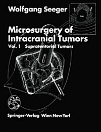 Microsurgery of Intracranial Tumors (Hardcover)