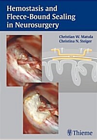 Haemostasis and Fleece-bound Sealing in Neurosurgery (Hardcover)