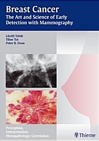 Breast Cancer: The Art and Science of Early Detection with Mammography (Hardcover)
