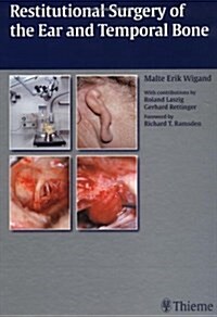 Restitutional Surgery of the Ear and the Temporal Bone (Hardcover)