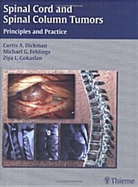 Spinal Cord and Spinal Column Tumors : Principles and Practice (Hardcover)