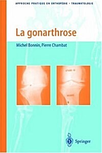 La Gonarthrose: Traitement Chirurgical: de Laarthroscopie a la Protha]se (Paperback)