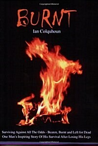 Burnt : Surviving Against All the Odds - Beaten, Burnt and Left for Dead. One Mans Inspiring Story of His Survival After Losing His Legs (Paperback, New ed)