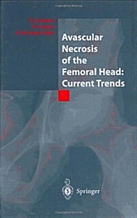 Avascular Necrosis of the Femoral Head: Current Trends: Current Trends (Hardcover, 2004)