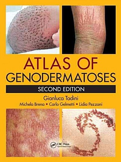 Atlas of Genodermatoses (Hardcover, 2)