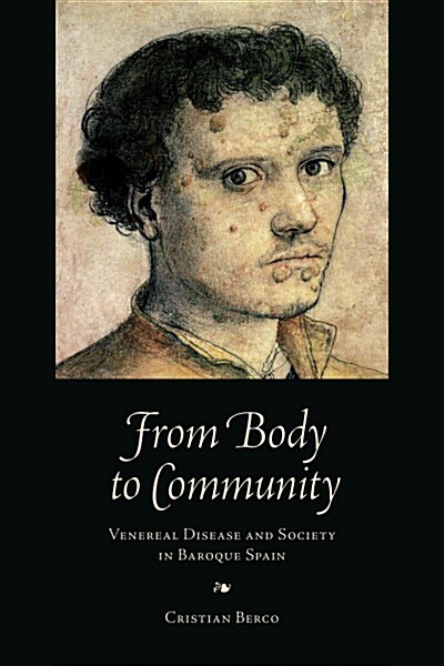 From Body to Community: Venereal Disease and Society in Baroque Spain (Hardcover)