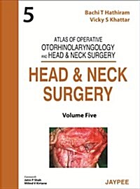 Atlas of Operative Otorhinolaryngology and Head & Neck Surgery: Head and Neck Surgery (Hardcover)