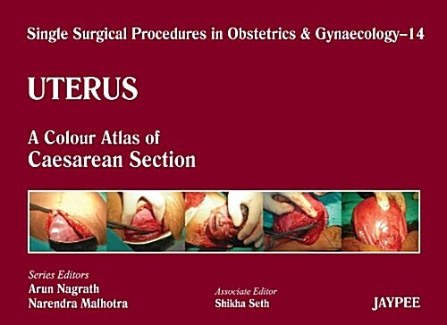 Single Surgical Procedures in Obstetrics and Gynaecology - Uterus : A Colour Atlas of Caesarean Section (Hardcover)