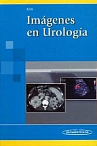 Imagenes En Urologia/ Images of Urology (Hardcover)