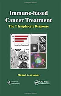 Immune-based Cancer Treatment (Hardcover, 1st)