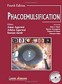 Phacoemulsification (Hardcover, 4 Rev ed)
