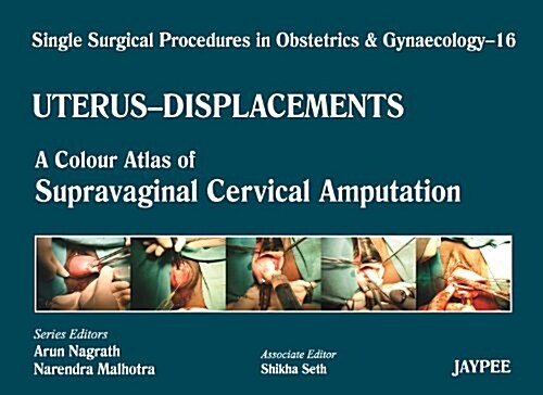 Single Surgical Procedures in Obstetrics and Gynaecology : A Colour Atlas of Supravaginal Cervical Amputation (Nadkarnis) (Hardcover)