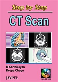 Step by Step Ct Scan with CD-Rom : 2007(Reprint) (Paperback)