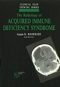 Radiology of Acquired Immune Deficiency Syndrome (Paperback)