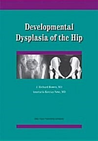 Developmental Dysplasia of the Hip (Paperback)