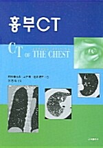 흉부 CT