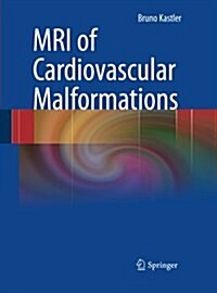 MRI of Cardiovascular Malformations (Paperback)