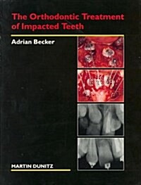 The Orthodontic Treatment of Impacted Teeth (Hardcover)
