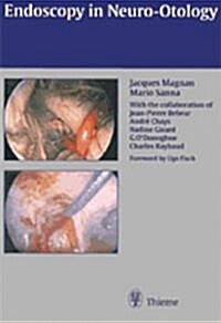Endoscopy in Neuro-Otology and Skull Base Surgery (At) (Hardcover)