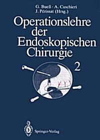 Operationslehre Der Endoskopischen Chirurgie: Band 2 (Hardcover)