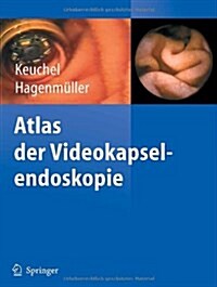 Atlas der Videokapselendoskopie (Paperback)