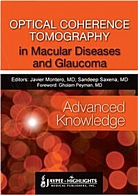 OCT IN MACULAR DISEASES AND GLAUCOMA (Hardcover)