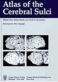 Atlas of the Cerebral Sulci (Hardcover)