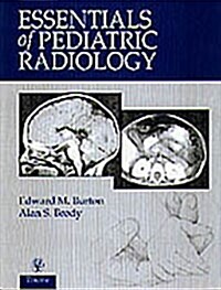Essentials of Pediatric Radiology (Hardcover)
