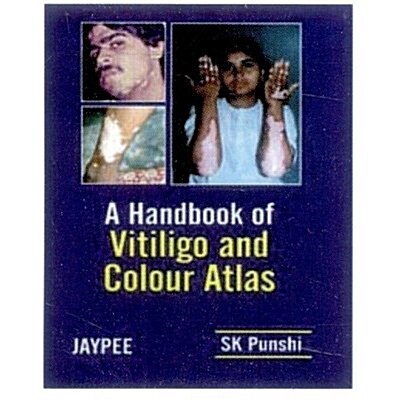 A Handbook of Vitiligo and Colour Atlas (Paperback)