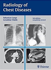 Radiology of Chest Diseases (Hardcover, 3)