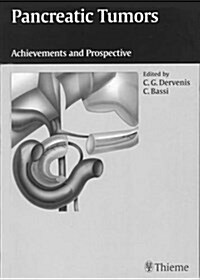Pancreatic Tumors : Achievements and Perspectives (Paperback)