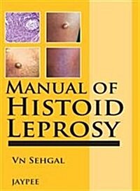Manual of Histoid Leprosy (Paperback)