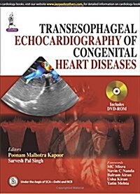 Transesophageal Echocardiography of Congenital Heart Diseases (Hardcover)