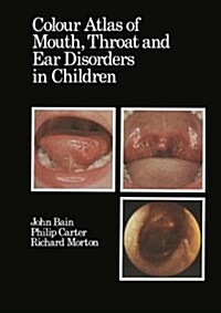 Colour Atlas of Mouth, Throat and Ear Disorders in Children (Hardcover)