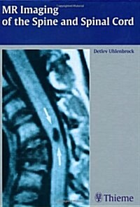 Mr Imaging of the Spine and Spinal Cord (Hardcover)