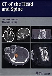 CT of the Head and Spine (Hardcover)