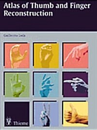 Thumb and Finger Reconstruction: Interesting Topics in Hand Surgery (Hardcover)