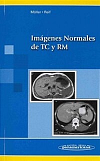 Imagenes normales de TC y RM / Normal Images of CT and MRI (Paperback, 1st, POC)