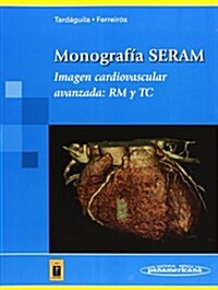 Imagen Cardiovascular Avanzada (Paperback, 1st)