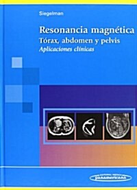 Resonancia Magnetica (Hardcover, 1st)