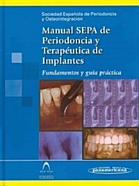 Manual SEPA de periodoncia y terap?tica de implantes / SEPA Manual of periodontics and implant therapy (Hardcover, 1st)
