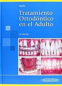 Tratamiento Ortodontico En El Adulto (Hardcover, 2nd)