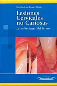 Lesiones cervicales no cariosas / Non-carious cervical lesions (Hardcover, 1st)