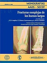 Fracturas Complejas De Huesos Largos (Paperback, 1st)