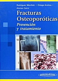 Fracturas Osteoporoticas (Hardcover, 1st)